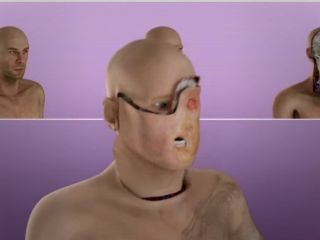 اهمیت نخستین پیوند کامل چشم در تاریخ پزشکی جهان