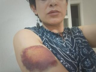 مهشید ناظمی خواهر پوران ناظمی، قربانی سرکوب و شکنجه در زندان‌های ترکیه