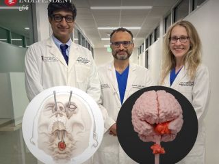 پزشکان امریکایی تومور سرطانی نخاع یک دختر ۱۹ ساله را از طریق چشم او خارج کردند