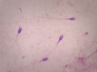 نتایج تحقیقی در آمریکا: اسپرم کلید حرارتی دارد و با ورود به واژن حرکاتش چرخشی می‌شود