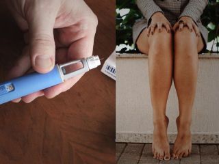 درباره «پاهای اوزمپیکی» چه می‌دانیم؟