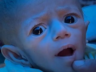 برگشتیم ببینیم چه بر سر نوزادی آمد که در غزه به‌ دلیل محاصره اسرائیل گرسنه مانده بود