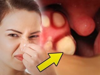 (تصاویر) ۷ غذایی که می‌توانند باعث بوی بد بدن شما شوند