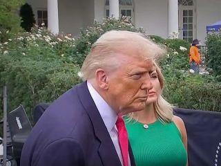 سلامت ترامپ در کانون توجه: علامت غیرعادی روی پوست او، چیست؟