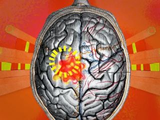 اثرات تغییرات اقلیمی بر عملکرد دستگاه عصبی انسان