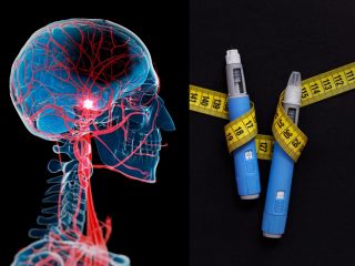 آیا اوزمپیک از سکته مغزی جلوگیری می‌کند؟