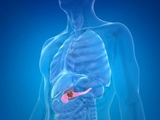 امید تازه در نبرد با سرطان لوزالمعده؛ واکسن جدید وارد فاز دوم آزمایش شد