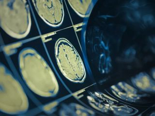 یک تراشه کامپیوتری می‌تواند ذهن افراد را با دقت ۷۴ درصد بخواند