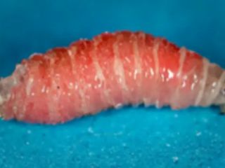 نخستین مورد انسانی ابتلا به انگل گوشت‌خوار در آمریکا ثبت شد