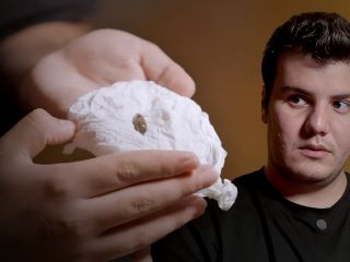 گلوله‌های جنگی در شکم متین هاشمی ۱۸ساله؛ من هیچ رویایی ندارم