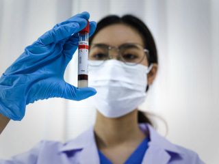 دانشمندان راه‌حل ناهمخوانی گروه خونی برای پیوند کلیه را کشف کردند