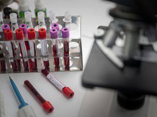 نتایج امیدبخش آزمایش خون برای تشخیص سریع۵۰ نوع سرطان