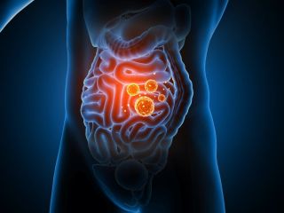 داروهای رایج مانند قرص سرماخوردگی و دیازپام می‌توانند تا سال‌ها بر سلامت روده اثر بگذارند