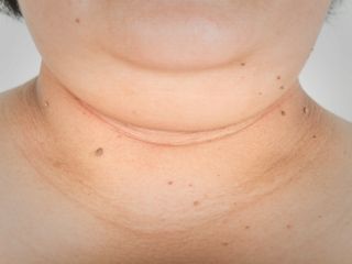 اندازه گردن چه چیزی در مورد سلامتی شما می‌گوید؟