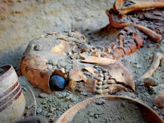 چشم‌ مصنوعی شهر سوخته در قوطی کبریت و در جیب امین اموال نگهداری می‌شود