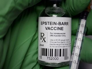 ویروس شایع عامل مونونوکلئوز به‌عنوان محرک احتمالی بیماری خودایمنی لوپوس شناسایی شد