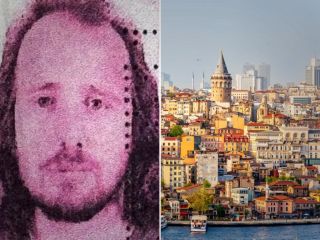 تراژدی درمانی در ترکیه: جوان ۳۶ ساله بلافاصله پس از انجام کاشت مو و درمان دندانپزشکی فوت کرد