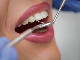 انقلابی در دندان‌پزشکی؛ یک ژل پروتئینی جدید مینای دندان را ترمیم و بازسازی می‌کند