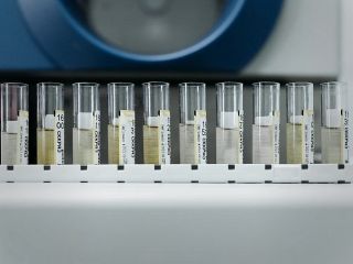 شناسایی ویروس فلج اطفال در فاضلاب آلمان؛ چرا مقام‌ها با وجود خطر کم نگران‌اند؟