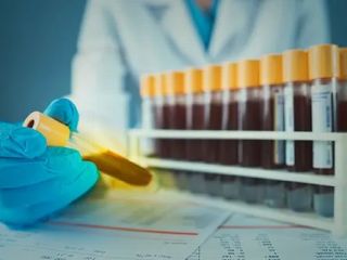 خون طلایی چیست و چرا دانشمندان در تلاشند نایاب‌ترین گروه خونی جهان را در آزمایشگاه بسازند؟