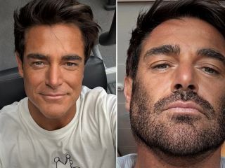 تغییر چهره محمدرضا گلزار طرفدارانش را شوکه کرد