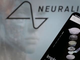 نورالینک؛ معلولان حرکتی بازوی رباتیک را با ذهن حرکت دادند