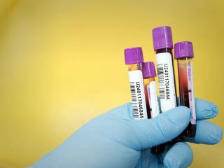 با مواد شیمیایی انباشته در بدن چه کنیم؟