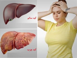 ۱۰ نشانه که فریاد می‌زند کبدتان چرب است!