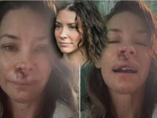 افشاگری ستاره سریال Lost از کاهش توانایی‌های ذهنی و آسیب مغزی‌ پس از سقوط