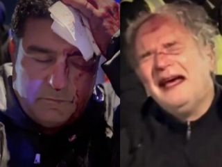 یورش پلیس لندن به تجمع ایرانیان؛ بازداشت مجروحان در راهروهای بیمارستان + ویدئو