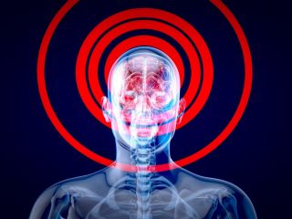 تحریک شنیداری با بسامد ۴۰ هرتز؛ راهی جدید برای درمان آلزایمر