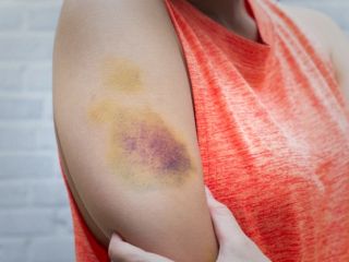 ۱۰ زنگ خطر پنهان: آیا بدن شما برای ویتامین C فریاد می‌زند؟