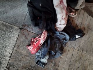 ایران، تنها کشور در جهان است که شهروندان مجروحش التماس می‌کنند «فقط ما را بیمارستان نبر»