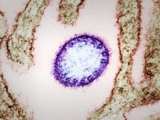 ویروس نیپا چیست و چقدر خطرناک است؟